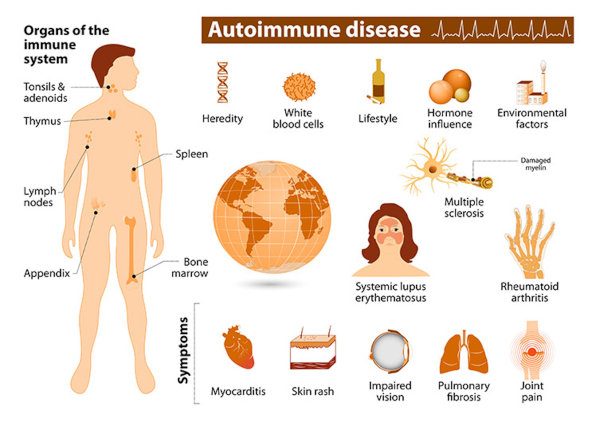 infographic with anatomy images describing symptoms