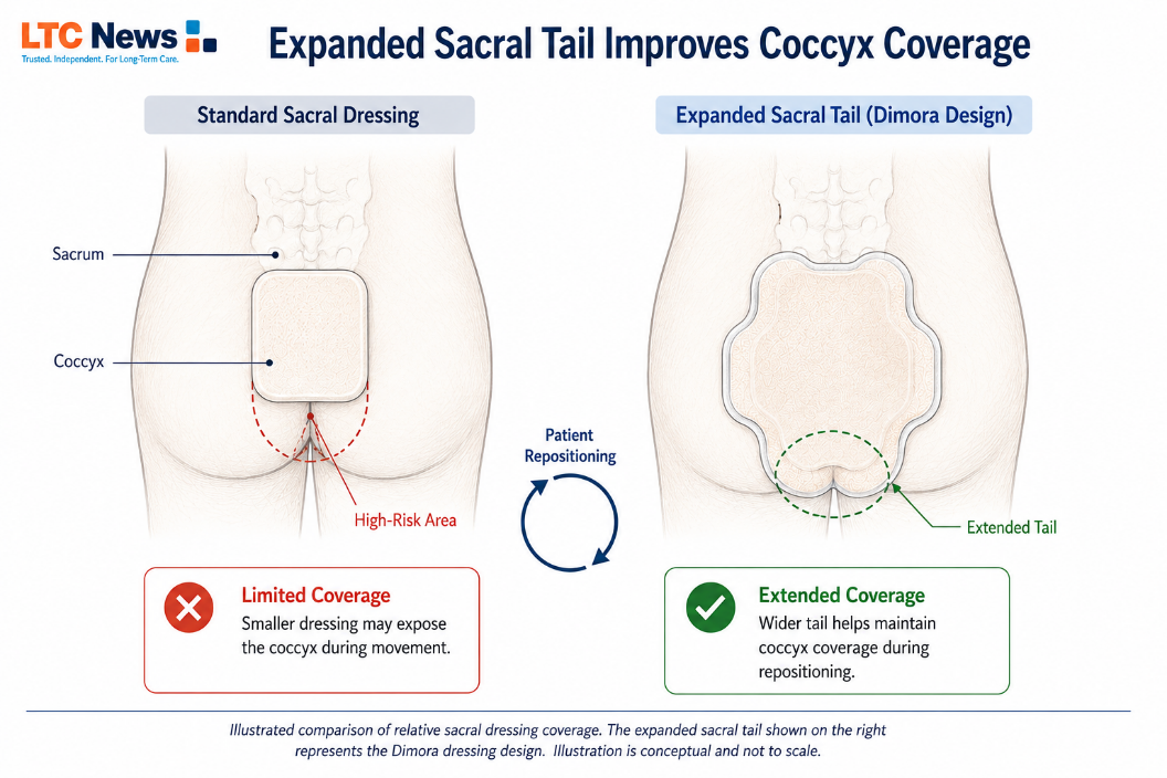 Dimora Sacrum Silicone Absorbent Wound Dressing Review: Designed to Help Protect Older Adults from Sacral Pressure Injuries - Image 2